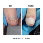 NAILSOFTHEDAY Onistop - regenerating oil against onycholysis
