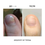 NAILSOFTHEDAY Onistop - regenerating oil against onycholysis