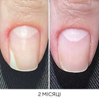 NAILSOFTHEDAY Onistop - regenerating oil against onycholysis