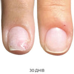 NAILSOFTHEDAY Onistop - regenerating oil against onycholysis