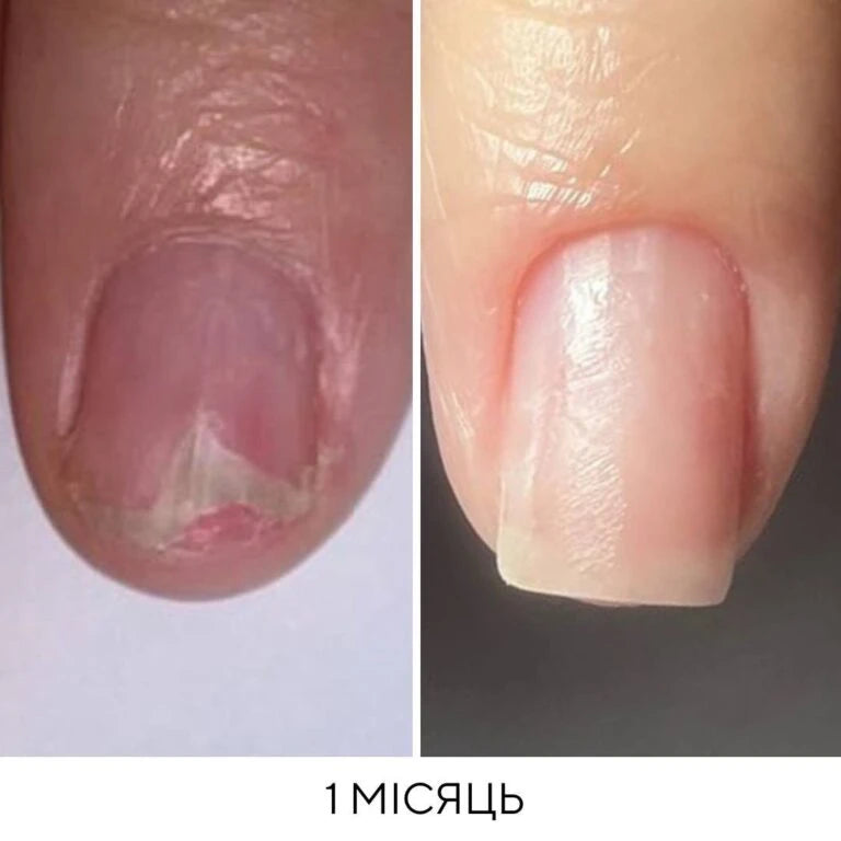 NAILSOFTHEDAY Onistop - regenerating oil against onycholysis