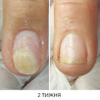 NAILSOFTHEDAY Onistop - regenerating oil against onycholysis