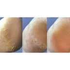 NAILSOFTHEDAY Anti crack cream, urea 12%, 30 ml