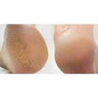 NAILSOFTHEDAY Anti crack cream, urea 12%, 30 ml